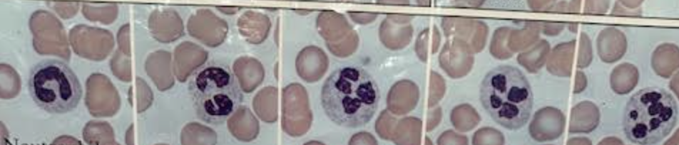 <p>What white blood cell is this</p>