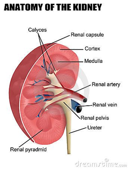 <ul><li><p>Typically caused by bacteria traveling upward from the bladder or from a blood stream infection that reaches the kidneys </p><ul><li><p>AKA: pyelonephritis - bacterial infection of the renal pelvis, tubules, and interstitial tissue of one or both kidneys </p></li><li><p>Other causes can be interstitial inflammation, abscess, kidney damage, tubular cell necrosis, a bladder infection, urinary stasis, or obstructions (tumors/structures/BPH) that cause reflux from the bladder into either or the ureters (ureterovesical or vesicoureteral reflux) </p></li></ul></li><li><p>Less common that lower tract infections, but a more common cayse or urosepsis </p></li></ul><p></p>