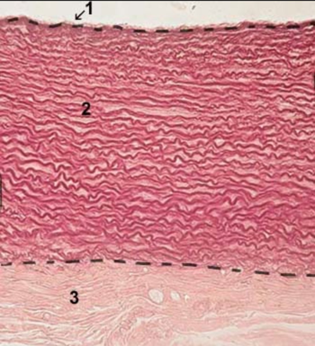 <p>Thick, wavy elastic layers in tunica media (middle layer)</p>