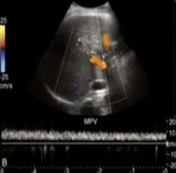 <ul><li><p>continuous forward flow</p></li><li><p>minimal respiratory alterations</p></li></ul><p></p>