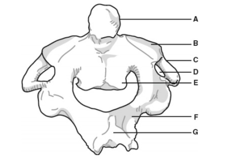<p>E</p>