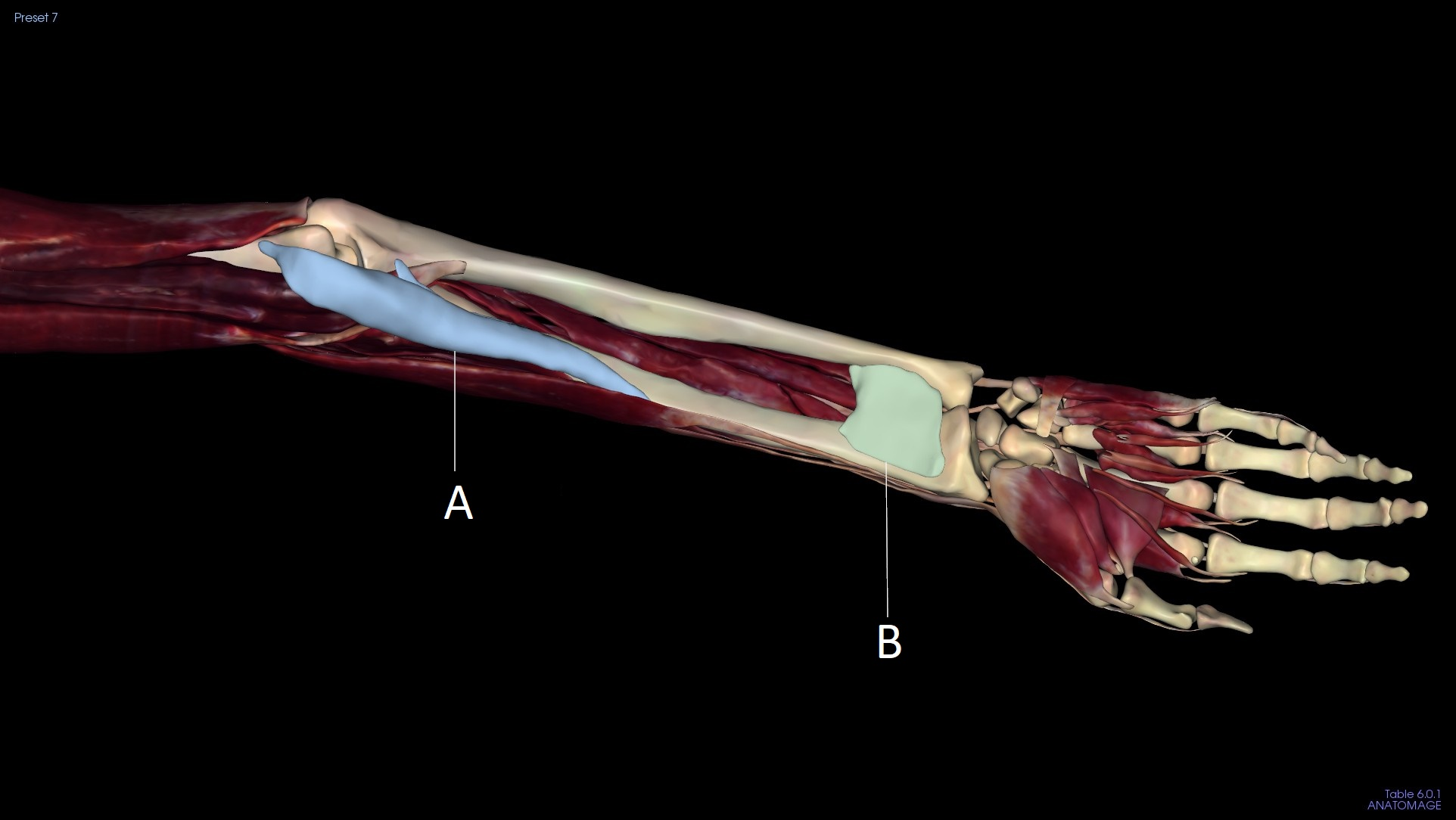 <p>A</p>