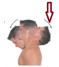 <p>Extension beyond normal range of motion.</p>