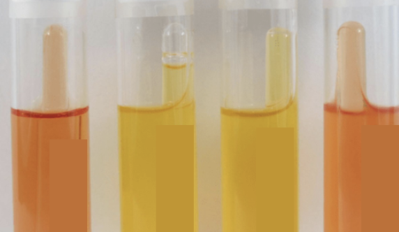 <p>Interpret the result of the <strong>Carbohydrate Fermentation test</strong>.</p>
