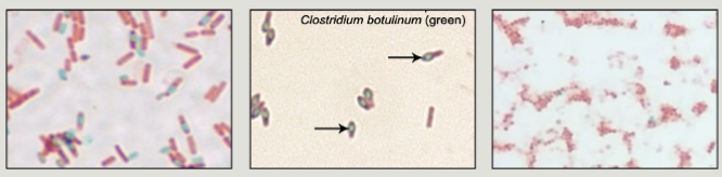 <p>Gram Positive Rods:<br>Bacillus (Anthracis) <br>Clostridium (Botulinum, Tetani, Difficile) </p>