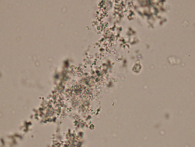 <p>Normal Crystals</p><p>Acidic urine</p>