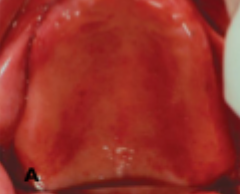 <p>what is this condition</p>