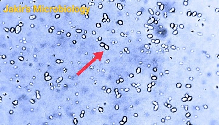 <p>What cell slide is this, and is it a prokaryote?</p>