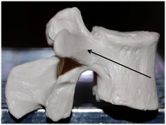 <p>Name this specific part of the lumbar vertebra.</p>