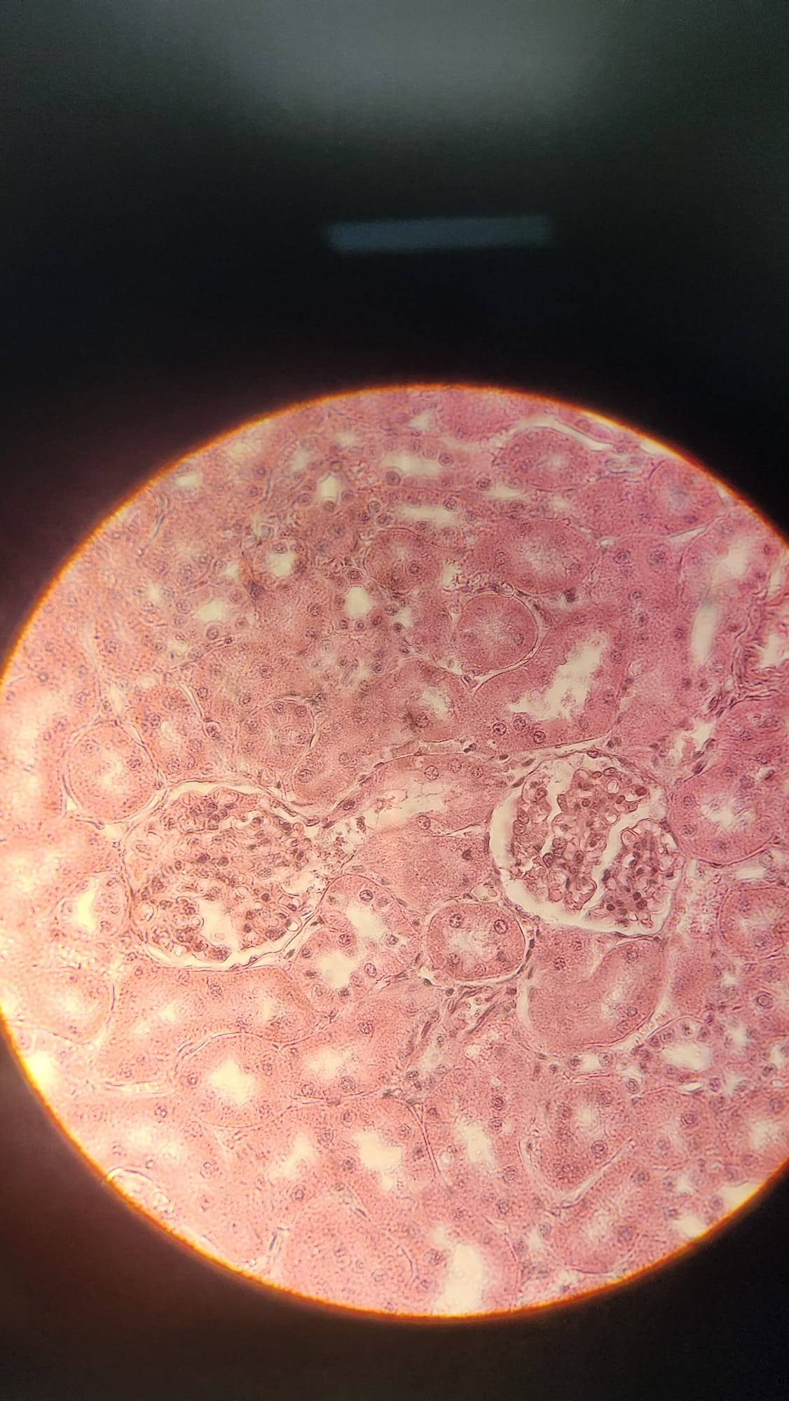 <p>What are the 2 round structures seen here?</p>
