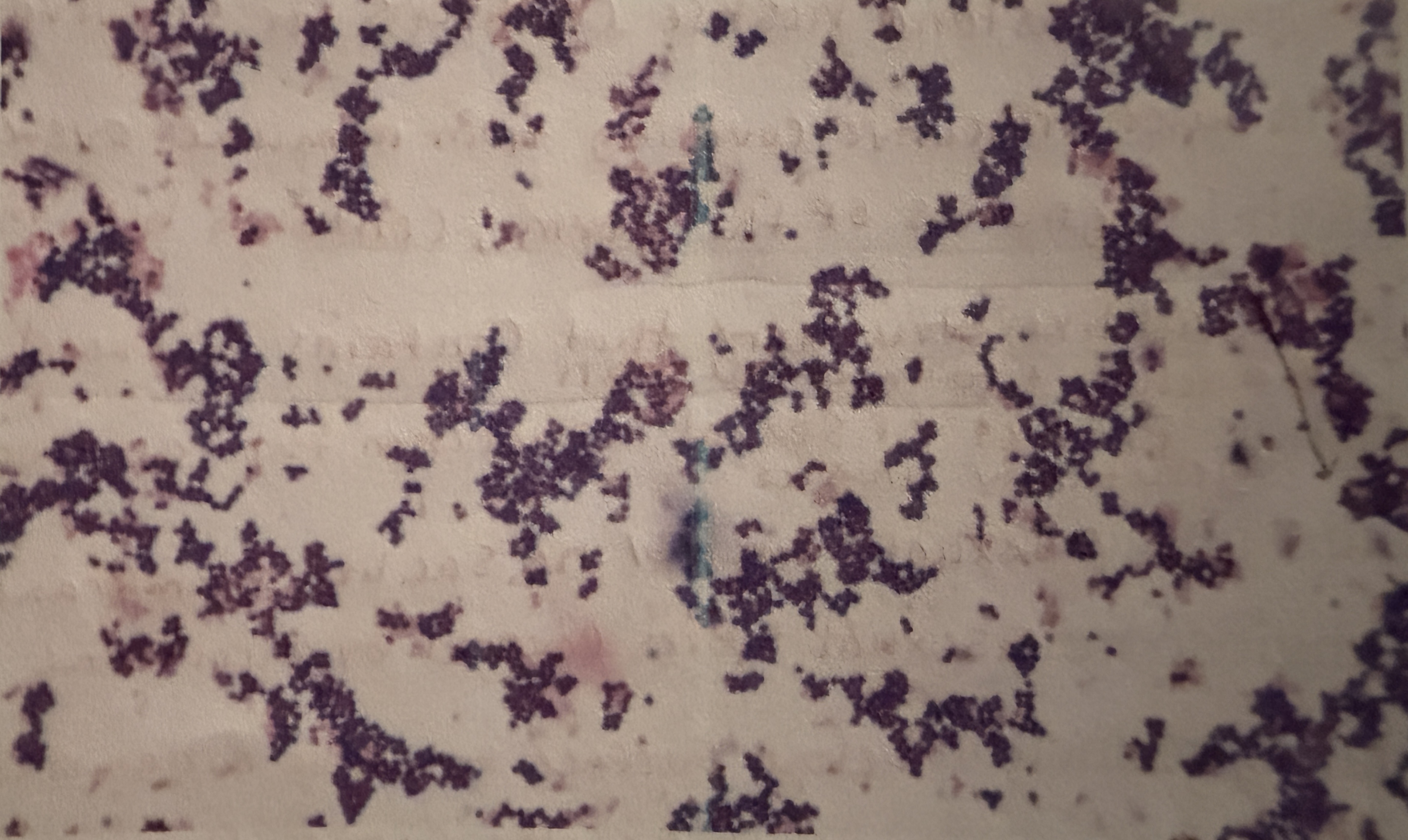 <p>Staphylococcus aureus</p>