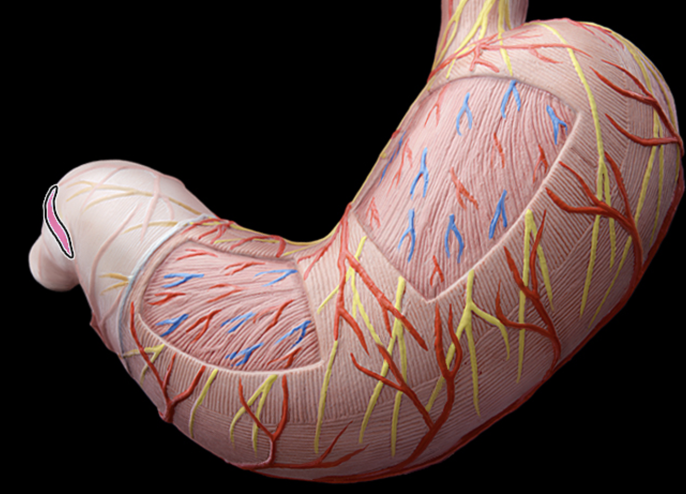 <p>pyloric splinter</p>