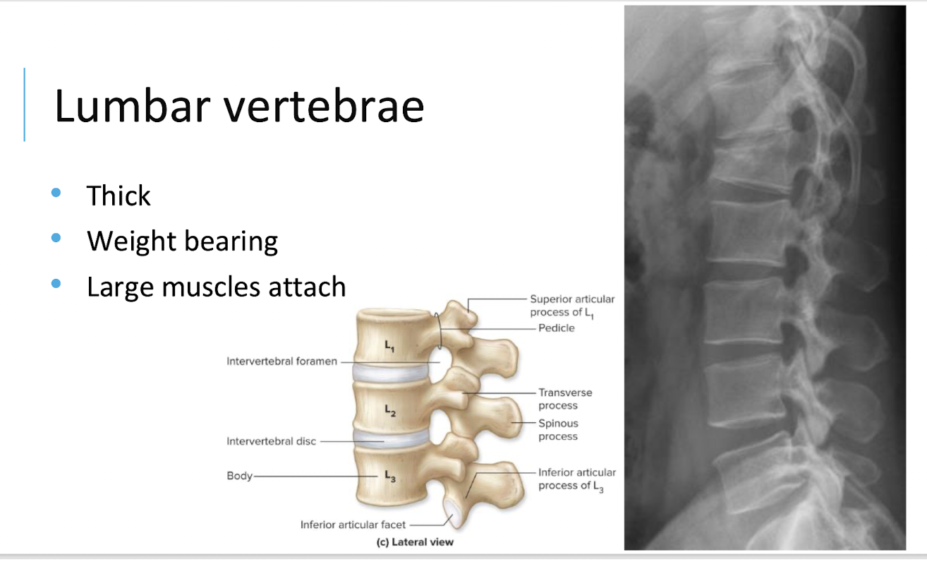 <p>They are thick, weight-bearing vertebrae with large muscle attachment areas</p>