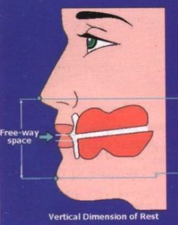 <p>vertical relation of rest position (VRP/VDR)</p>