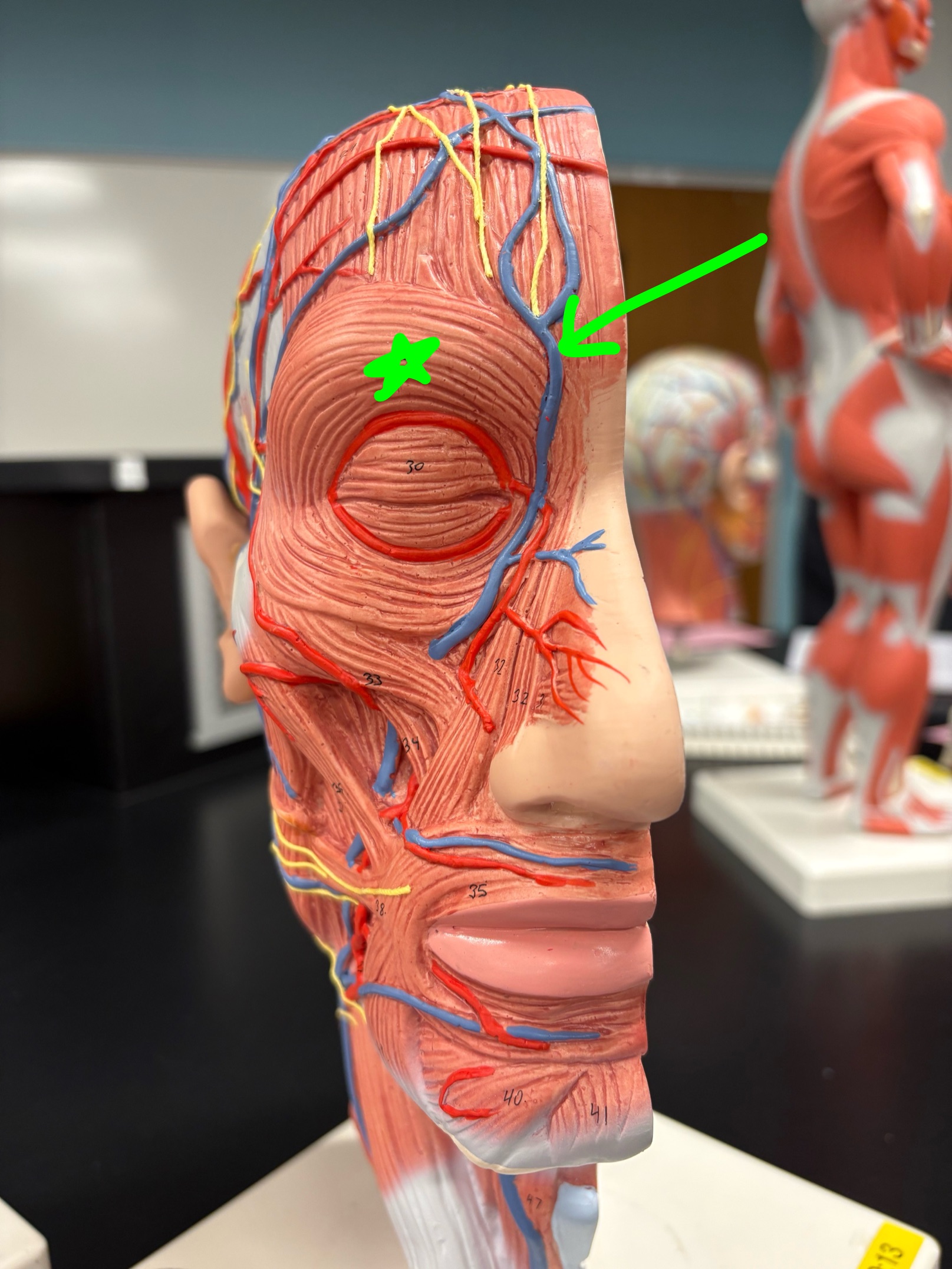 <p>Name the muscle.</p>