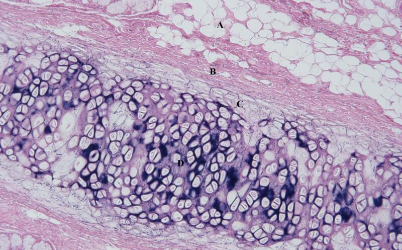 <p>What kind of cartilage is this?</p>