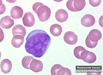 <p>what is a myeloblast?</p>