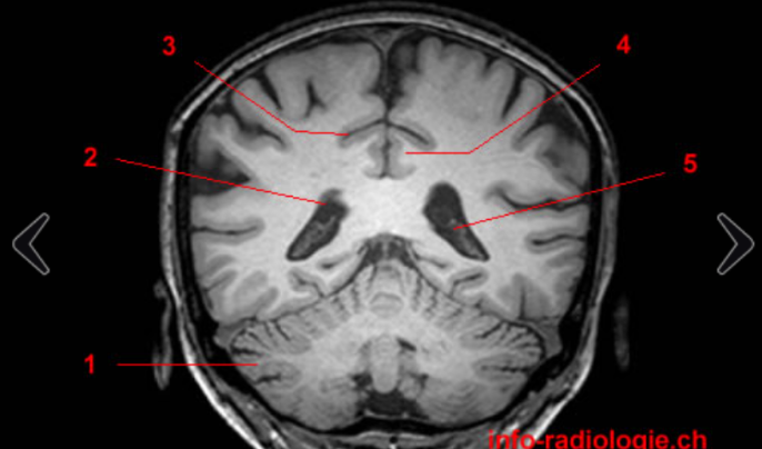 <p>Label 1 - 5</p>