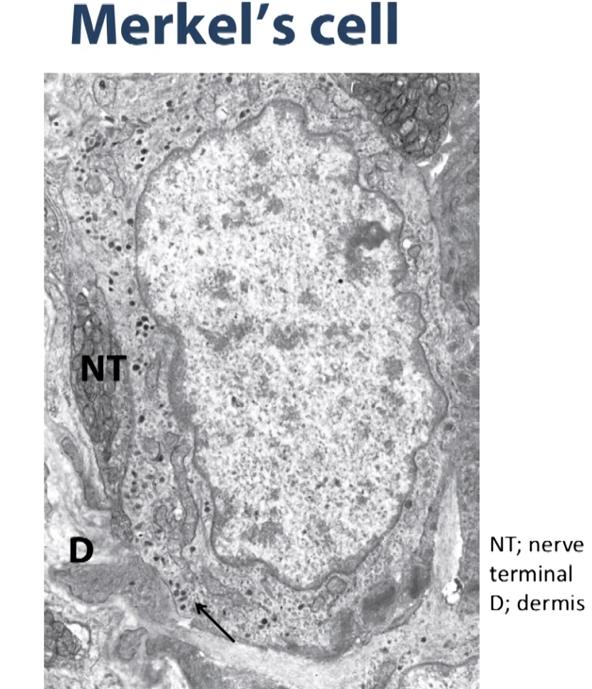 <p>Then you have the Merkel cell which closely resembles a nerve terminal </p>