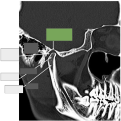 <p>TMJ: This is the</p>
