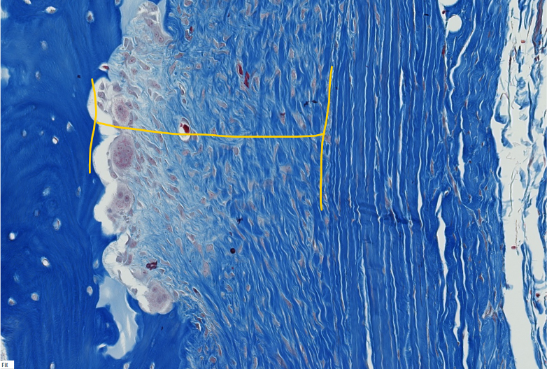 <p><span style="font-family: "Calibri Light";">In actively growing bone, the periosteum has two visible layers. <br><br>ID the layer within the yellow bracketed portion .</span></p><p></p><p><span style="font-family: "Calibri Light";">(</span><span>This is a high-power magnification of the periosteum of a long bone.)</span></p>