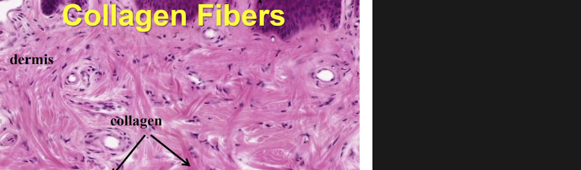 <p>identify the type of connective tissue</p>