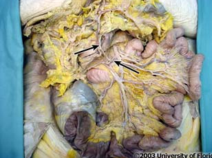 <p>what artery is pictured?</p>