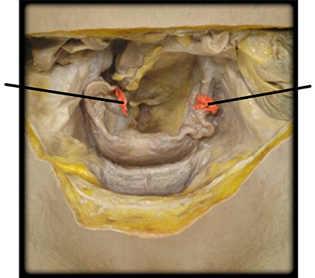 <p>what structure is highlighted?</p>