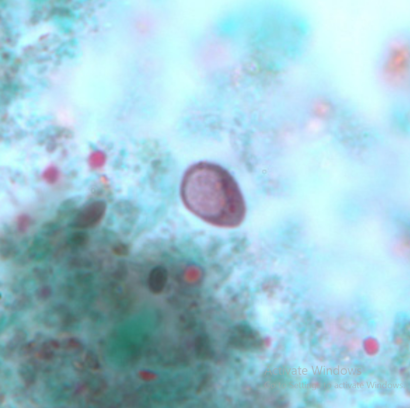 <ol><li><p>Species</p></li><li><p>Stage</p></li><li><p>Distinguishing feature</p></li><li><p>Source of infection</p></li></ol><p></p>