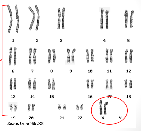 <p>size (largest to smallest)</p><p>centromere position</p><p>g-banding</p>