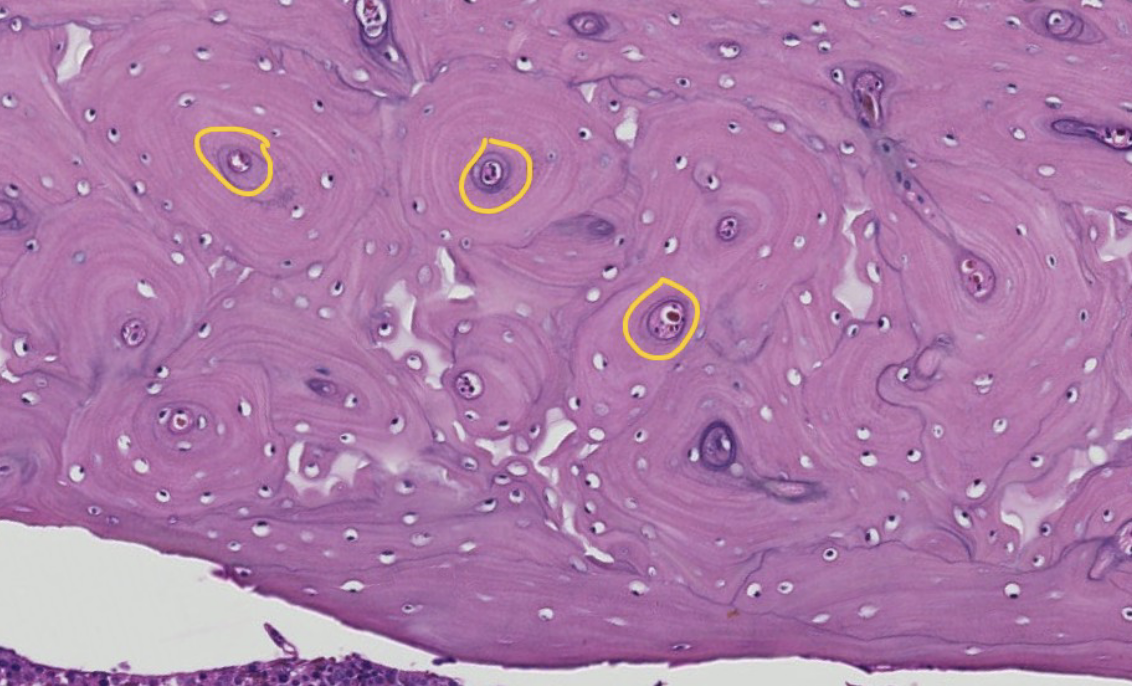 <p>this is the diaphysis (shaft) of a long bone in a transverse (cross) section. ID the encircled region of the osteon</p>