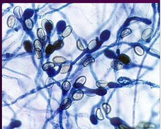 <p><span style="background-color: transparent;">Identify the zoospores.</span></p>