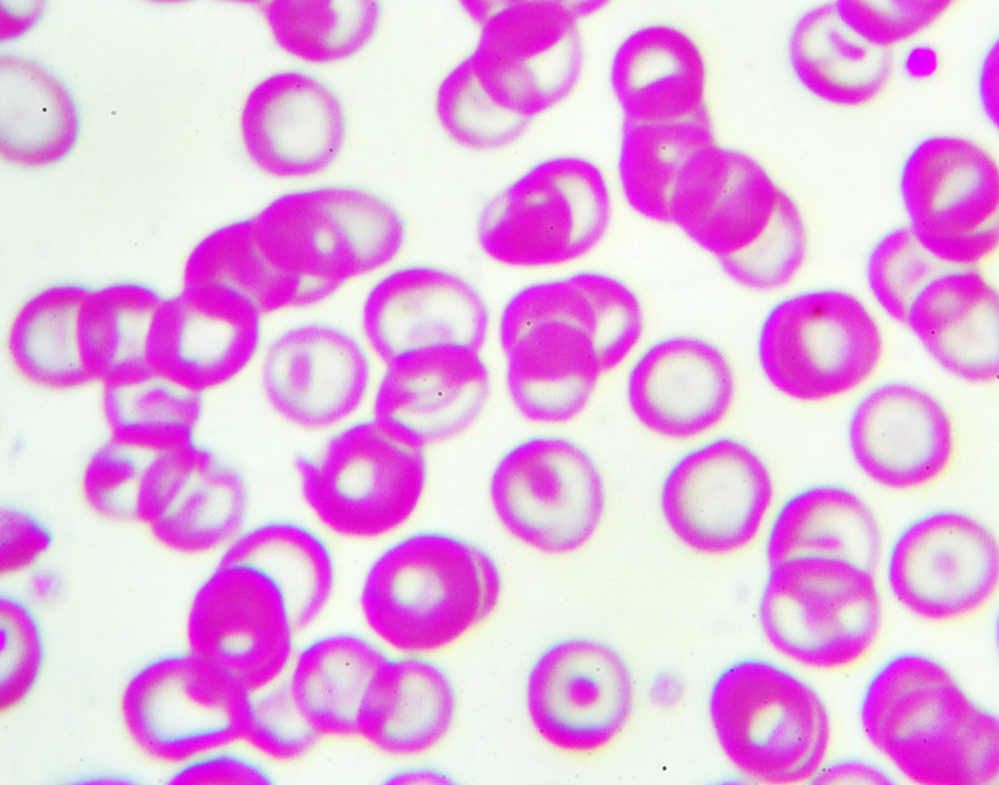 <p>HYPOCHROMIC</p>