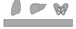 <p>describe WW</p>