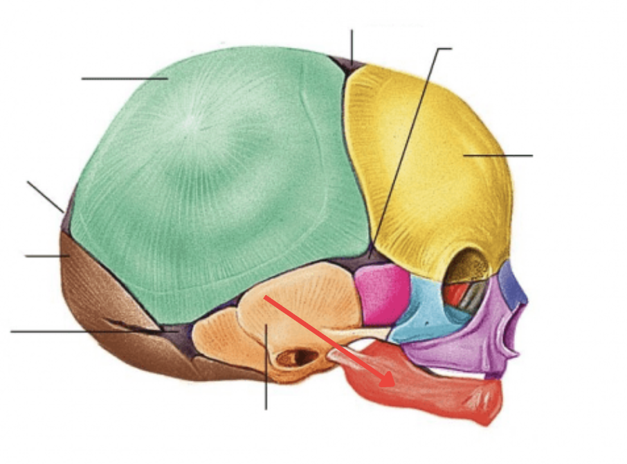 term image