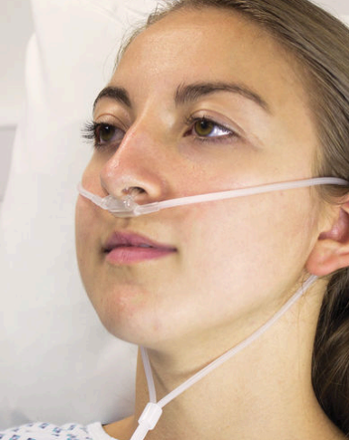 <ul><li><p><span><span>Delivers supplemental O2 mixed with RA (21%), usually 1–6 lpm</span></span></p></li><li><p><span><span>Fio2 - 24 to 44%</span></span></p></li></ul><p></p>