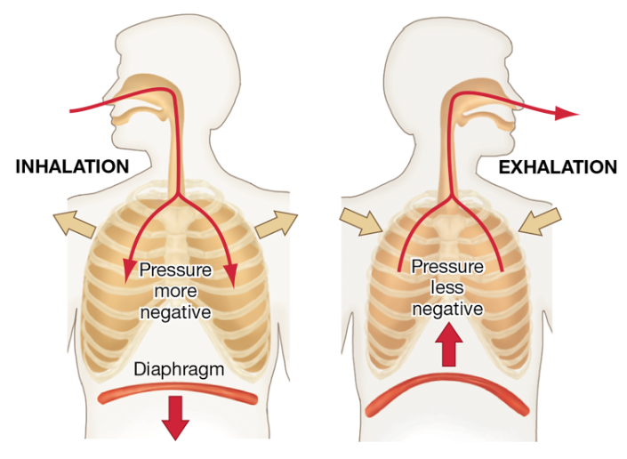 <p>Positive vs. Negative Pressure Ventilation</p>