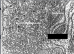 <p>Identify the specific structure</p>