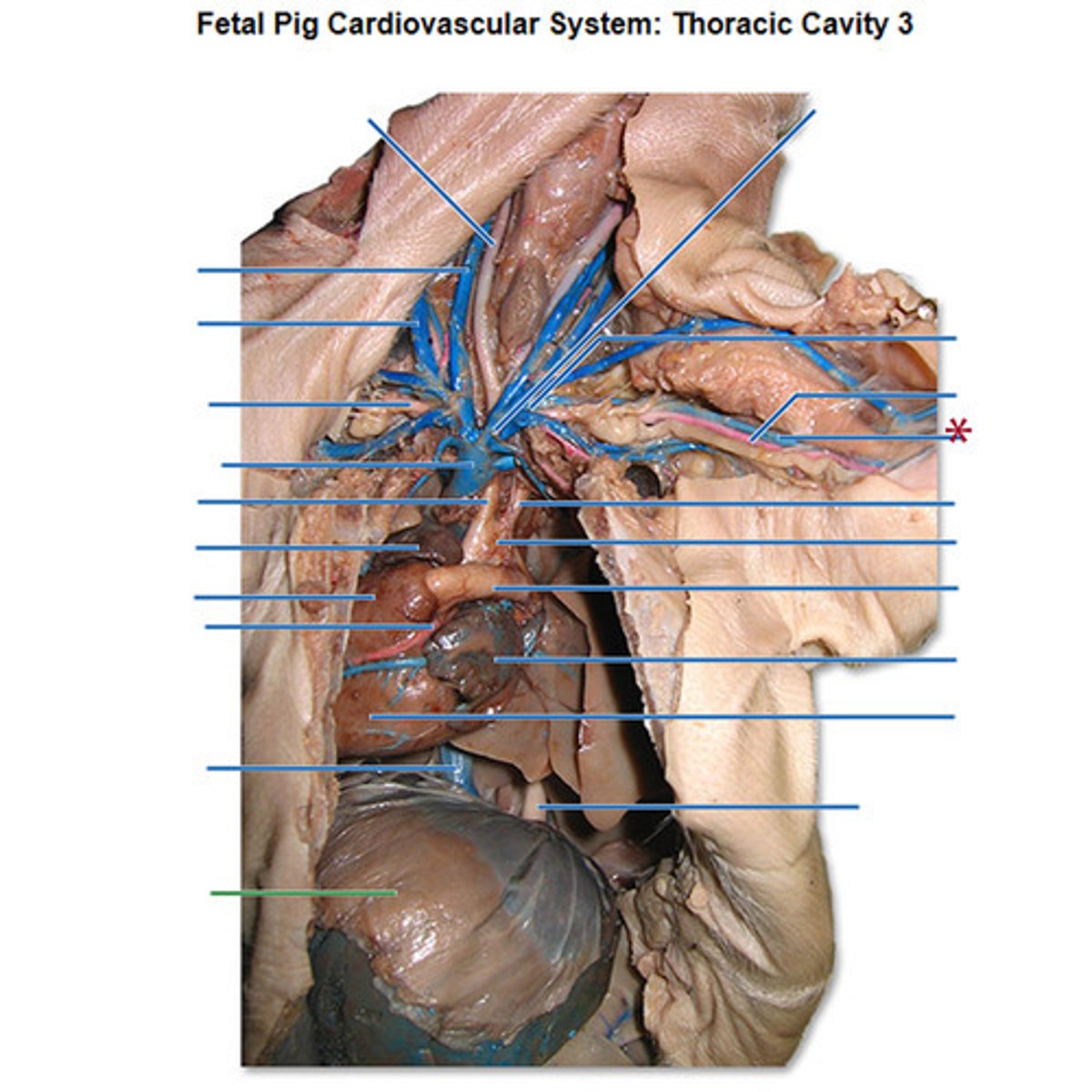 <p>vein in upper arm (starred in pic; right and left)</p>