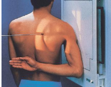 <p>LATERAL (RAO/LAO)</p>