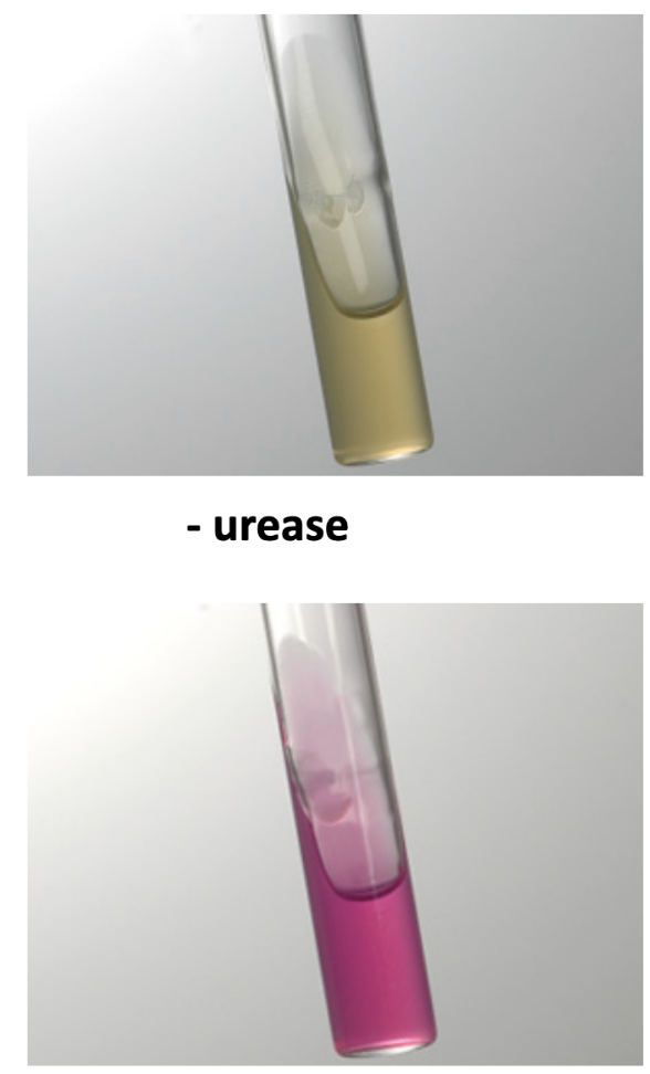 <p><span>Example negative bacteria in a Urease test?</span></p>