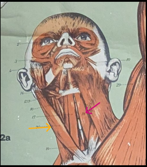 <ul><li><p>yellow= sternocleidomastoid</p></li><li><p>pink=<strong>Sternohyoid</strong></p></li></ul><p></p>