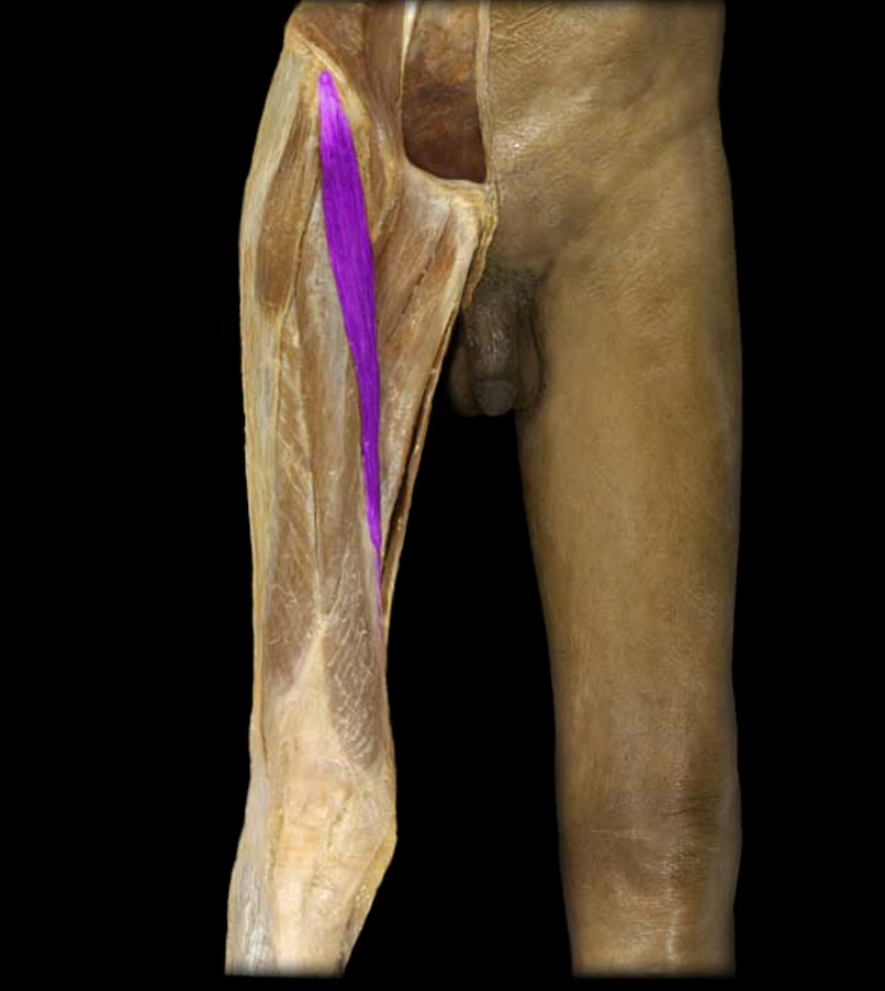 <p>What muscle is this?</p>