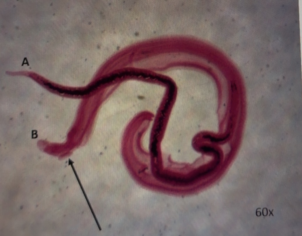 <p>The female worm is ___. The male worm is A. The black arrow is pointing to the ___.</p>