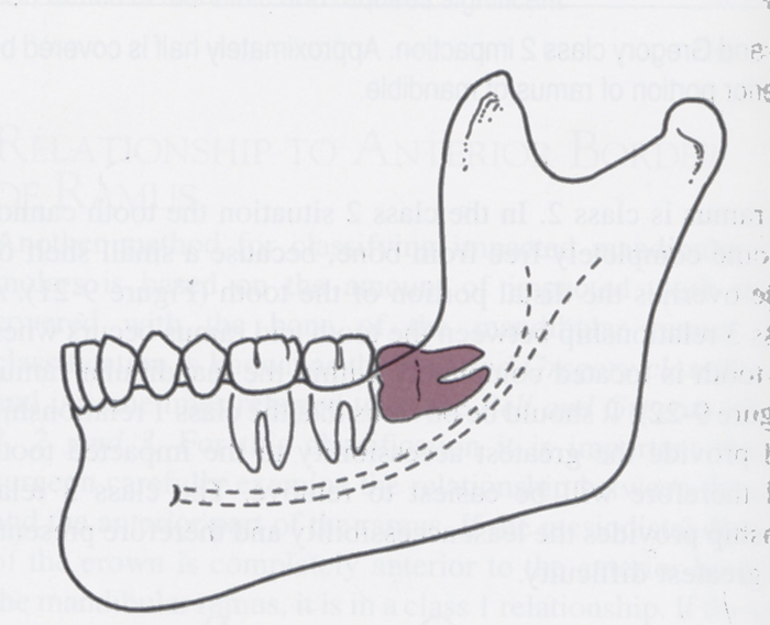 <p>what is the PG classification?</p>