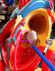 <p>Valve from the left ventricle to the aorta (white dots)</p>