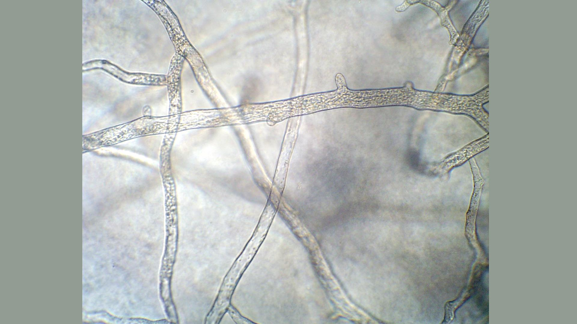 <p>A fungus that lacks septa and hence whose body is made up of a continuous cytoplasmic mass that may contain hundreds or thousands of nuclei</p>