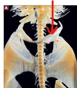 <p>The U-shaped skeletal complex forming the pectoral girdle, situated just posterior to the last gill slit</p>