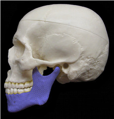 <p>Single bone forming the lower jaw, the only movable skull bone</p>