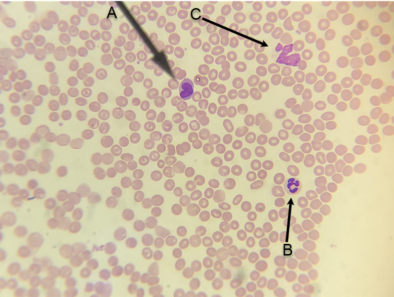 <p>In the image above, identify formed elements A and B.&nbsp; (For fun:&nbsp; formed element C ruptured, but do you have a guess as to what it was?)</p>